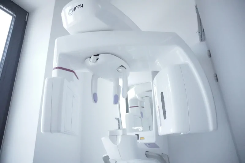 Pracownia RTG Nasza pracownia rentgenowska wyposażona jest w zaawansowany aparat MyRay do wykonywania zdjęć pantomograficznych i tomograficznych, oraz do wykonywania zdjęć wewnątrz ustnych – radiowizjografia.